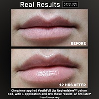 通販］Revision Skincare リビジョン スキンケア YouthFull Lip 