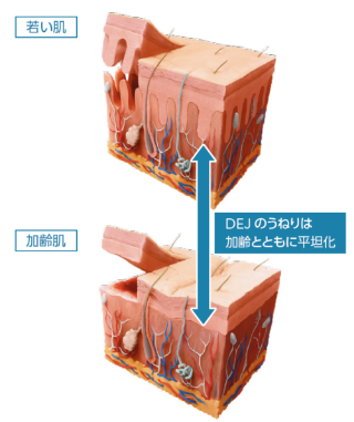 DEJのうねりは加齢とともに平坦化