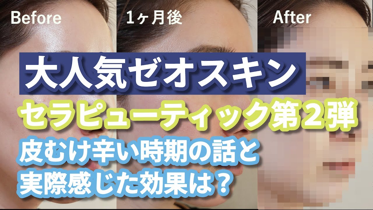 通販］ZO SKIN HEALTH ゼオスキンヘルス 選べる洗顔セット（ジェントル 